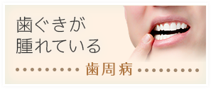 歯ぐきが腫れている：歯周病
