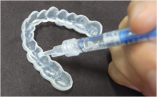 ホームホワイトニング