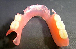 ノンクラスプ義歯(バルプラスト)